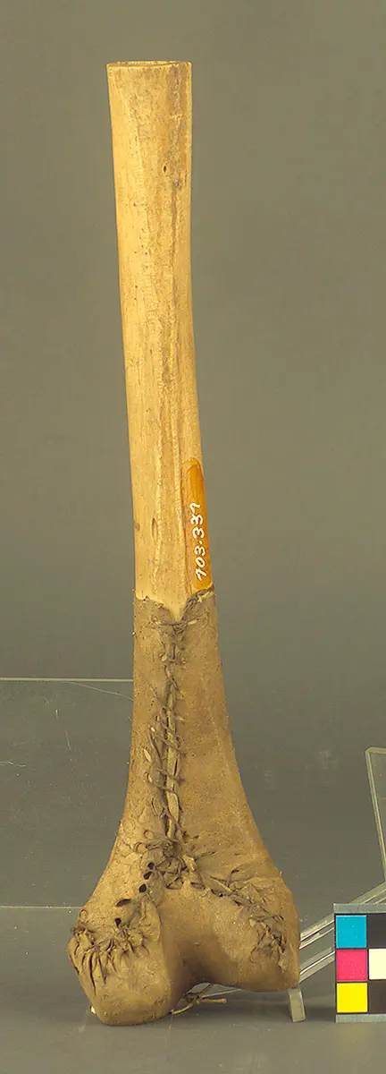 Knochentrompete