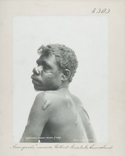 "Coongardi", warrior, Gilbert River tribe, Schmucknarben
