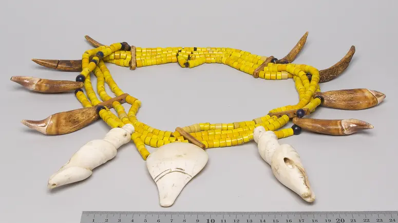 Breast ornament