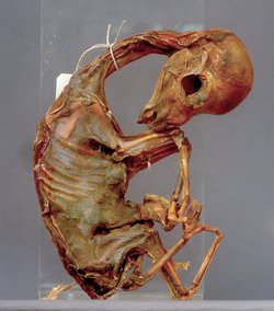 Llama foetus